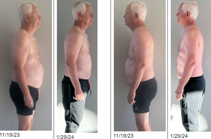 Client progress photo, before and after