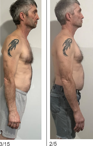 Client progress photo, before and after